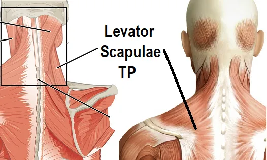 Self-paced Online Home Study 12 CE Trigger Point & Neuromuscular Therapy Basics
