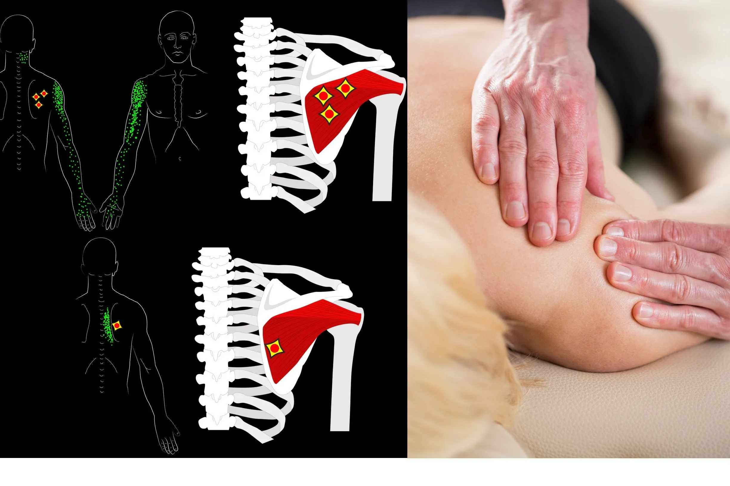 Self-paced Online Home Study 12 CE Trigger Point & Neuromuscular Therapy Basics