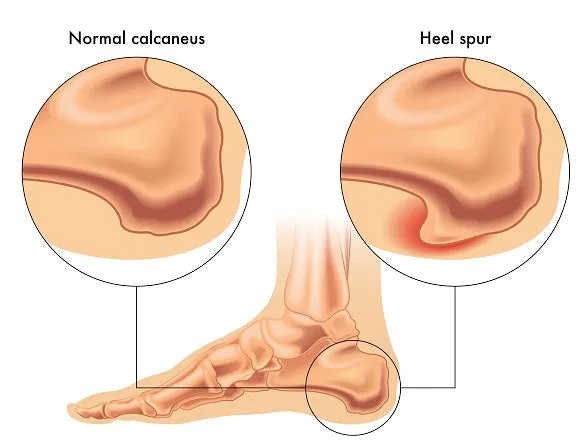 Self-paced Online Home Study 6 CE Hour Advanced Medical Foot Massage