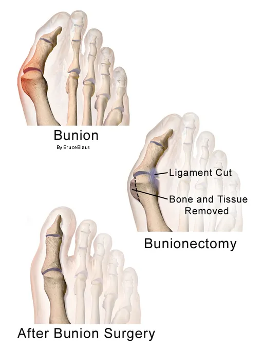 Self-paced Online Home Study 6 CE Hour Advanced Medical Foot Massage