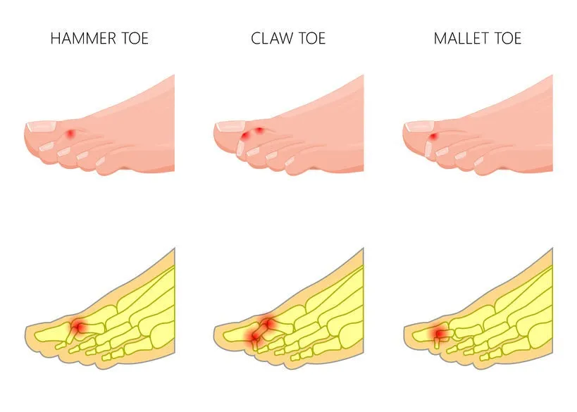 Self-paced Online Home Study 6 CE Hour Advanced Medical Foot Massage
