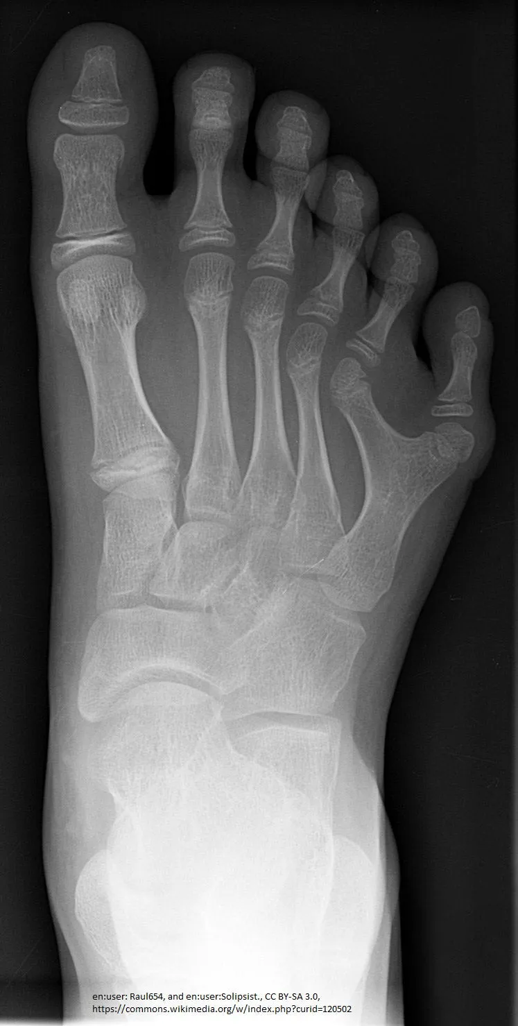 Self-paced Online Home Study 6 CE Hour Advanced Medical Foot Massage